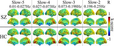 Dynamic Functional Connectivity Strength Within Different Frequency-Band in Schizophrenia